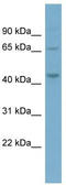Phosphatidylinositol-5-Phosphate 4-Kinase Type 2 Alpha antibody, TA342235, Origene, Western Blot image 