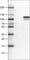 Matrix Metallopeptidase 9 antibody, AMAb90805, Atlas Antibodies, Western Blot image 