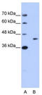 PDZ domain-containing protein GIPC1 antibody, TA345929, Origene, Western Blot image 