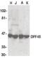 DNA Fragmentation Factor Subunit Alpha antibody, PA5-19877, Invitrogen Antibodies, Western Blot image 