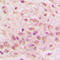 GTPase, IMAP Family Member 4 antibody, LS-C353478, Lifespan Biosciences, Immunohistochemistry frozen image 