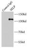 GMP-140 antibody, FNab06852, FineTest, Immunoprecipitation image 