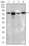 Bile acyl-CoA synthetase antibody, GTX60703, GeneTex, Western Blot image 