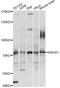 Ecto-NOX disulfide-thiol exchanger 1 antibody, LS-C749286, Lifespan Biosciences, Western Blot image 