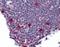 Lymphokine-activated killer T-cell-originated protein kinase antibody, orb96469, Biorbyt, Immunohistochemistry paraffin image 