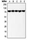LIM domain kinase 1 antibody, orb214193, Biorbyt, Western Blot image 