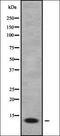 Kalirin RhoGEF Kinase antibody, orb336328, Biorbyt, Western Blot image 