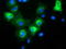 Mitogen-Activated Protein Kinase 7 antibody, TA502189, Origene, Immunofluorescence image 