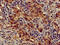 Beclin 1-associated autophagy-related key regulator antibody, CSB-PA741052LA01HU, Cusabio, Immunohistochemistry paraffin image 