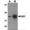 Influenza A Virus Hemagglutinin  antibody, NBP1-75494, Novus Biologicals, Western Blot image 