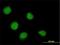SSX Family Member 4B antibody, H00006759-M02, Novus Biologicals, Immunofluorescence image 