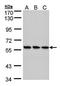 RNA Guanylyltransferase And 5'-Phosphatase antibody, orb73511, Biorbyt, Western Blot image 