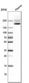Complement Factor H antibody, HPA049176, Atlas Antibodies, Western Blot image 