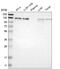 Epidermal Growth Factor Receptor Pathway Substrate 15 antibody, NBP1-89221, Novus Biologicals, Western Blot image 