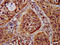ST3 Beta-Galactoside Alpha-2,3-Sialyltransferase 4 antibody, LS-C669896, Lifespan Biosciences, Immunohistochemistry paraffin image 
