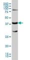 Galactose-1-phosphate uridylyltransferase antibody, H00002592-M01, Novus Biologicals, Western Blot image 