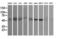 STK38L antibody, M06774, Boster Biological Technology, Western Blot image 