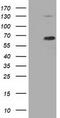 Pyruvate Kinase L/R antibody, CF501416, Origene, Western Blot image 