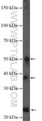 Hemojuvelin BMP Co-Receptor antibody, 11758-1-AP, Proteintech Group, Enzyme Linked Immunosorbent Assay image 
