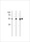 DMRT Like Family A2 antibody, 60-806, ProSci, Western Blot image 