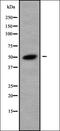 Chromodomain Helicase DNA Binding Protein 9 antibody, orb338180, Biorbyt, Western Blot image 