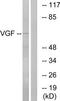 VGF Nerve Growth Factor Inducible antibody, TA314668, Origene, Western Blot image 