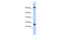 Chromosome 4 Open Reading Frame 46 antibody, 26-618, ProSci, Enzyme Linked Immunosorbent Assay image 