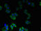 Phosphatidylinositol-4,5-Bisphosphate 4-Phosphatase 2 antibody, orb357231, Biorbyt, Immunocytochemistry image 