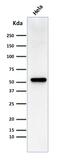 Fascin Actin-Bundling Protein 1 antibody, GTX34720, GeneTex, Western Blot image 