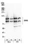 EWS RNA Binding Protein 1 antibody, NB200-183, Novus Biologicals, Western Blot image 