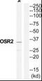 Odd-Skipped Related Transciption Factor 2 antibody, PA5-39571, Invitrogen Antibodies, Western Blot image 