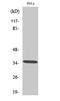 Olfactory Receptor Family 4 Subfamily C Member 6 antibody, A17267, Boster Biological Technology, Western Blot image 