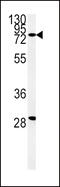 Zinc Finger FYVE-Type Containing 16 antibody, 61-798, ProSci, Western Blot image 