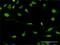 F-Box Protein 11 antibody, H00080204-M02, Novus Biologicals, Immunocytochemistry image 