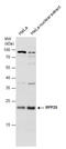 Ribonuclease P And MRP Subunit P25 antibody, GTX130473, GeneTex, Western Blot image 