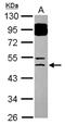 BTB Domain Containing 6 antibody, NBP2-15627, Novus Biologicals, Western Blot image 