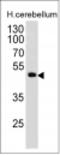 Paired Box 6 antibody, M00273-1, Boster Biological Technology, Western Blot image 