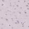 Secreted frizzled-related protein 4 antibody, PA5-62219, Invitrogen Antibodies, Immunohistochemistry paraffin image 