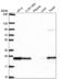RAB8B, Member RAS Oncogene Family antibody, NBP2-57641, Novus Biologicals, Western Blot image 