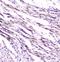 Fatty Acid Binding Protein 3 antibody, MA5-27875, Invitrogen Antibodies, Immunohistochemistry paraffin image 