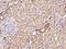 BRISC And BRCA1 A Complex Member 1 antibody, 200837-T08, Sino Biological, Immunohistochemistry paraffin image 