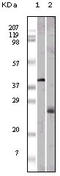Apolipoprotein M antibody, STJ97842, St John