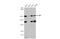 APC Regulator Of WNT Signaling Pathway antibody, GTX116009, GeneTex, Western Blot image 