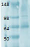 Sodium-iodide symporter antibody, TA309483, Origene, Western Blot image 