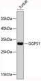 Geranylgeranyl Diphosphate Synthase 1 antibody, 19-335, ProSci, Western Blot image 