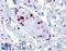 Small Nuclear Ribonucleoprotein Polypeptide A antibody, LS-B4419, Lifespan Biosciences, Immunohistochemistry paraffin image 
