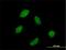 RNA Polymerase III Subunit C antibody, H00010623-B03P, Novus Biologicals, Immunocytochemistry image 