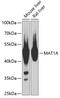 Methionine Adenosyltransferase 1A antibody, 18-744, ProSci, Western Blot image 