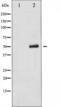 Keratin, type II cytoskeletal 8 antibody, TA325613, Origene, Western Blot image 