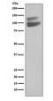 Cadherin-5 antibody, M02632, Boster Biological Technology, Western Blot image 